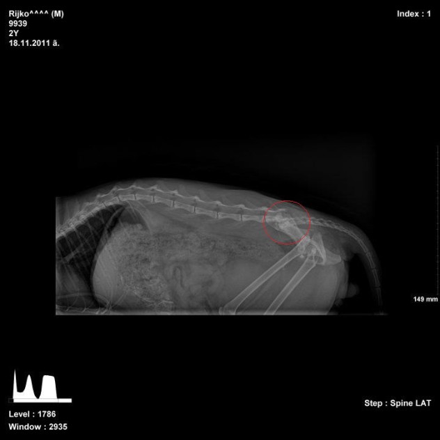 The two vertebrae compressing the spinal nerve